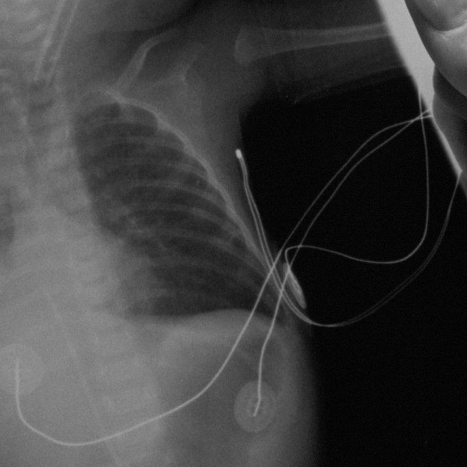 Health imaging heritage xray